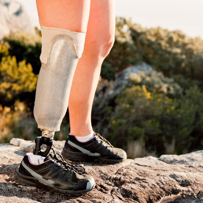 Photo of hiker with prosthetic leg